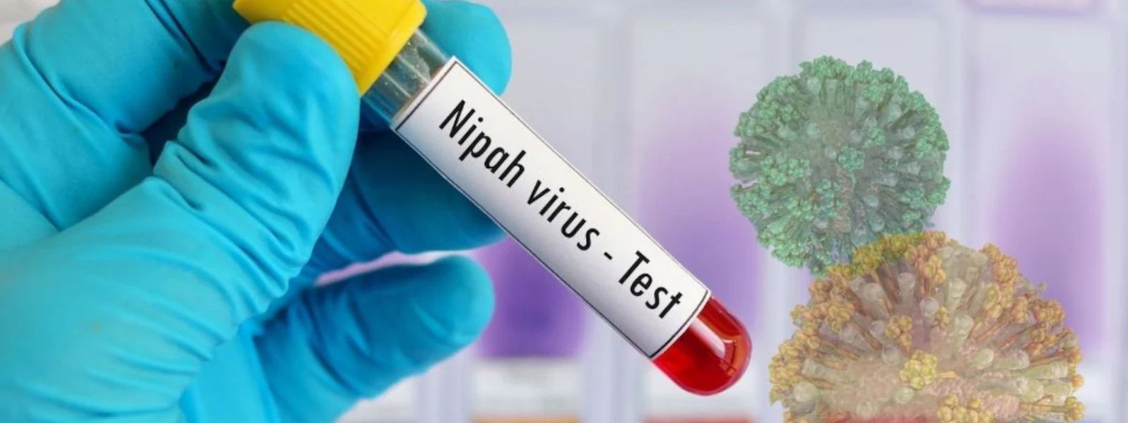 No Risk of Nipah Virus Spreading to Sri Lanka